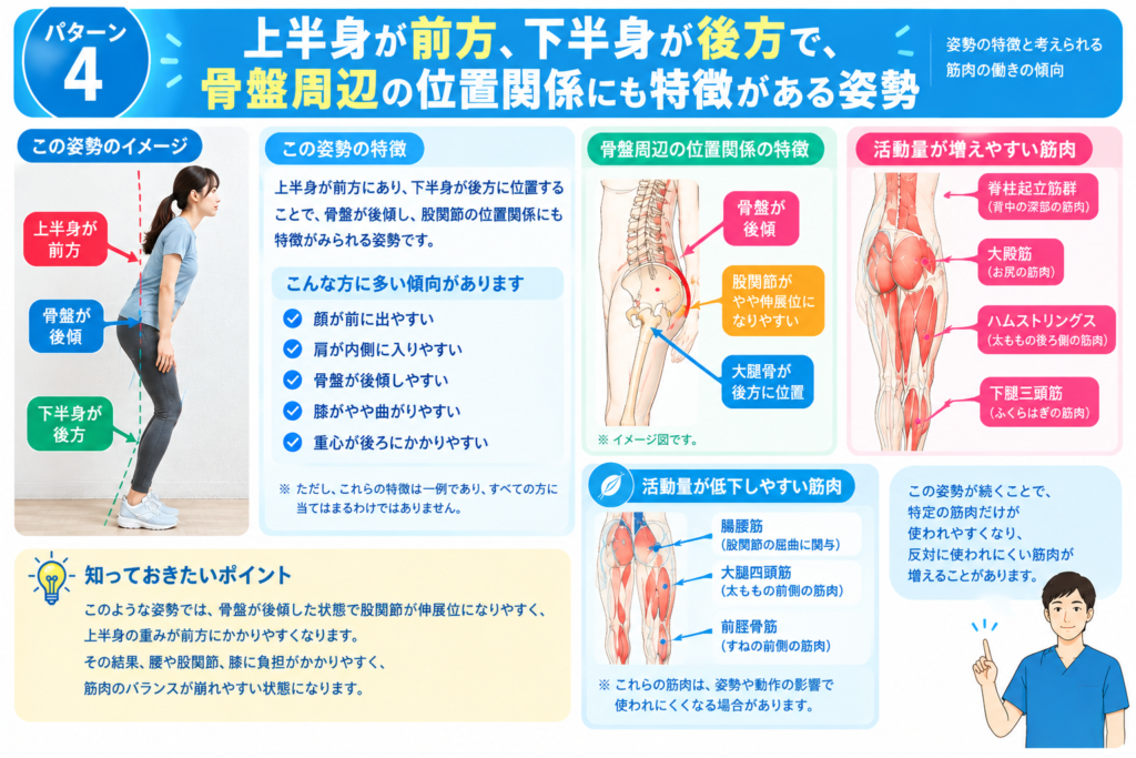上半身前方下半身後方骨盤後傾の姿勢の特徴