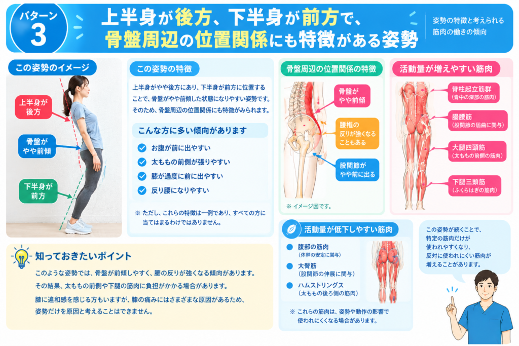 上半身後方下半身前方骨盤前傾姿勢の方の特徴